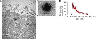 Exosomes: Innocent Bystanders or Critical Culprits in Neurodegenerative Diseases